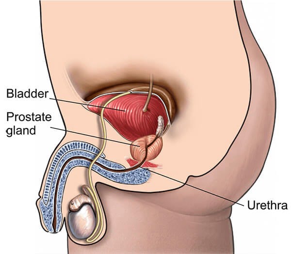  TitanFlow_prostate.jpg